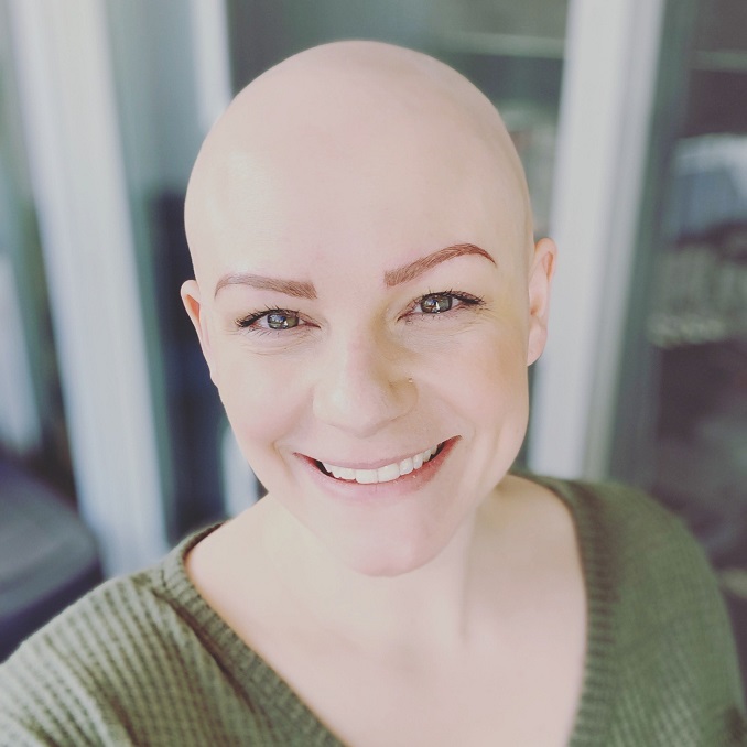 Charitable Choices: The Canadian Alopecia Areata Foundation